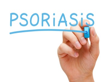 Understanding Psoriasis